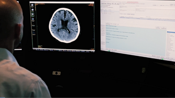How AI Is Accelerating Care Delivery in Critical Cases