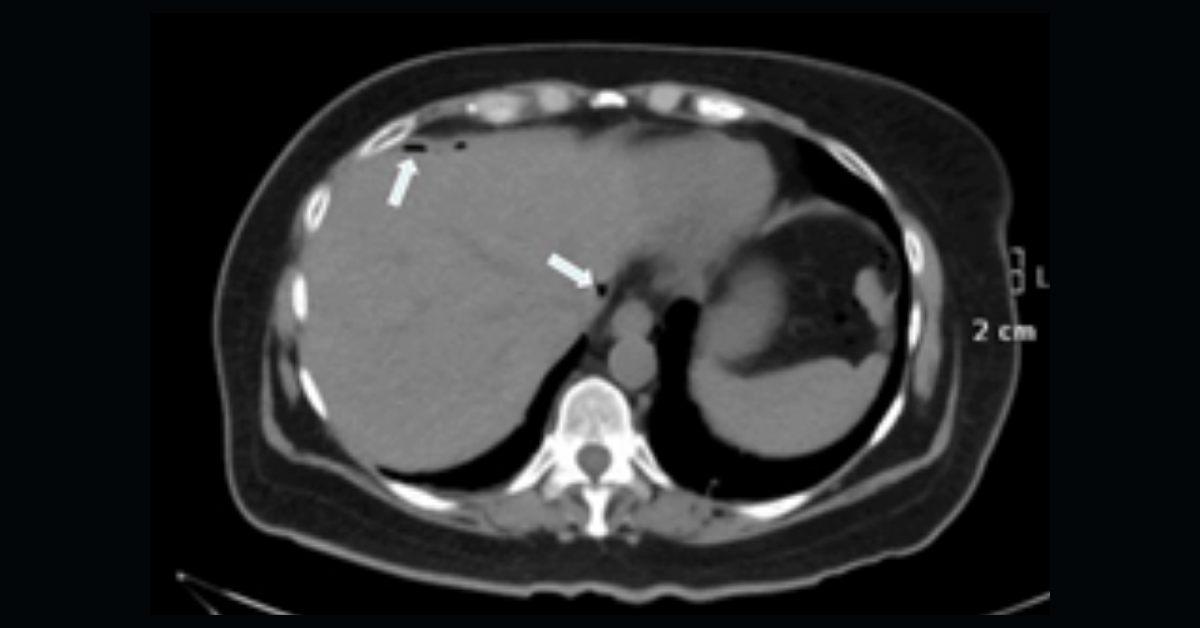 New Radiology AI Models Reduce Time to Care