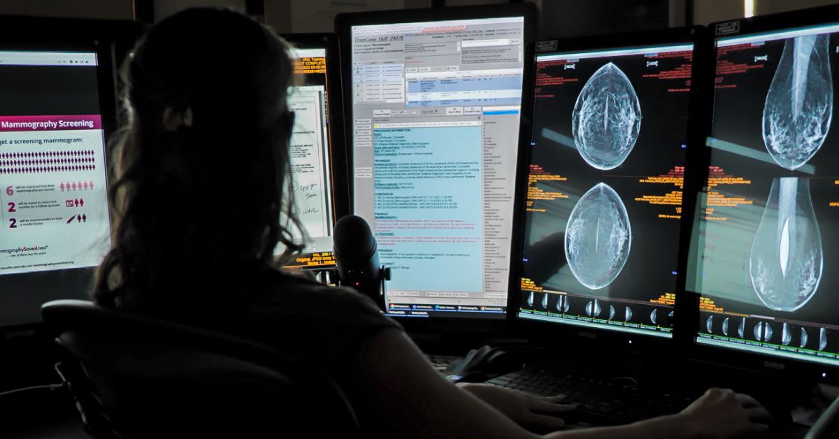New Screening Mammogram Recommendations Don’t Go Far Enough