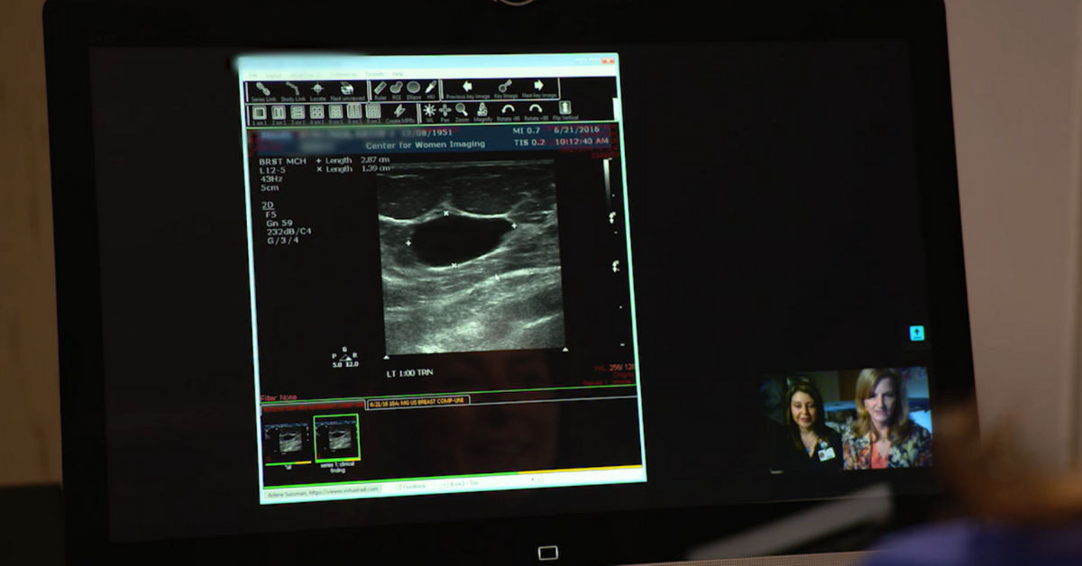 mammography