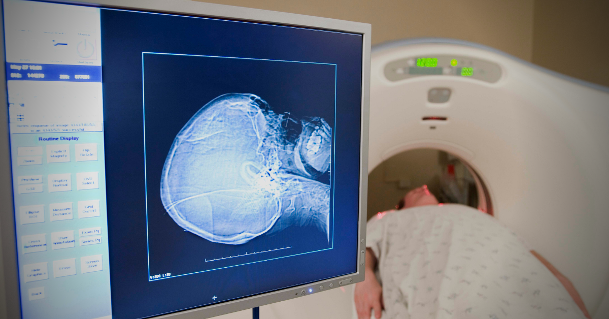Why Teleradiology May Be a Better Option than Locum Tenens for Temporary Radiologist Staffing