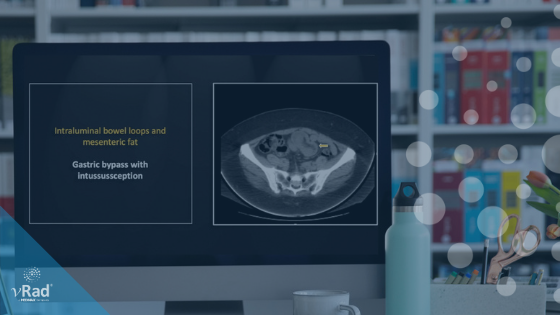 Bite-Sized CME: Accessible, Relevant 15-Minute Case Reviews