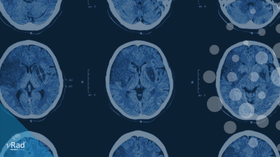 strokecenters